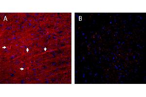 anti-Synaptic Ras GTPase Activating Protein 1 (SYNGAP1) (AA 1185-1199), (C-Term) antibody