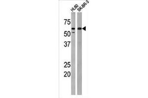 MYT1 antibody  (pThr495)