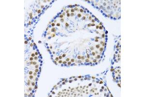 Immunohistochemistry (IHC) image for anti-DEAD (Asp-Glu-Ala-Asp) Box Polypeptide 46 (DDX46) (AA 682-1031) antibody (ABIN1679515)