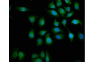 Immunofluorescence staining of A549 cells with ABIN7160149 at 1:133, counter-stained with DAPI. (ABHD6 antibody  (AA 105-211))