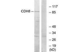 Western blot analysis of extracts from RAW264. (Cadherin 8 antibody  (AA 491-540))