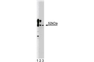 Western Blotting (WB) image for anti-Calcium/calmodulin-Dependent Protein Kinase II alpha (CAMK2A) (AA 448-460) antibody (ABIN968458) (CAMK2A antibody  (AA 448-460))