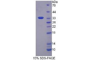 SDS-PAGE (SDS) image for Single-Strand-Selective Monofunctional Uracil-DNA Glycosylase 1 (SMUG1) (AA 1-270) protein (His tag) (ABIN6237202) (SMUG1 Protein (AA 1-270) (His tag))