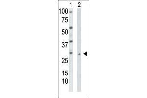 The anti-TK2 Pab (ABIN1882141 and ABIN2841224) is used in Western blot to detect TK2 in HepG2 cell lysate (Lane 1) and mouse liver tissue lysate (Lane 2). (TK2 antibody  (N-Term))