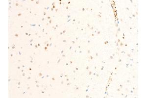 Immunohistochemistry (IHC) image for anti-Intercellular Adhesion Molecule 1 (ICAM1) (pTyr512) antibody (ABIN6255938)