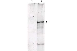 Image no. 1 for anti-Ataxia Telangiectasia Mutated (ATM) (pSer1981) antibody (ABIN401482) (ATM antibody  (pSer1981))