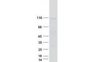 Western Blotting (WB) image for Importin 11 (IPO11) (Transcript Variant 2) protein (Myc-DYKDDDDK Tag) (ABIN2730454)