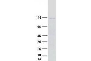 Validation with Western Blot (Importin 11 Protein (IPO11) (Transcript Variant 2) (Myc-DYKDDDDK Tag))