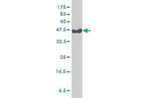 PSCD3 monoclonal antibody (M01A), clone 6D3-1A9 Western Blot analysis of PSCD3 expression in Hela S3 NE . (Cytohesin 3 antibody  (AA 1-179))