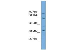WB Suggested Anti-PTDSS2 Antibody Titration:  0. (PTDSS2 antibody  (Middle Region))