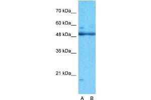 Host:  Rabbit  Target Name:  ARID5A  Sample Type:  721_B  Lane A:  Primary Antibody  Lane B:  Primary Antibody + Blocking Peptide  Primary Antibody Concentration:  1ug/ml  Peptide Concentration:  5ug/ml  Lysate Quantity:  25ug/lane/lane  Gel Concentration:  0. (ARID5A antibody  (N-Term))