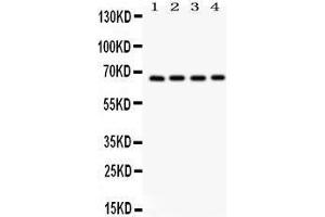 Western Blotting (WB) image for anti-Optineurin (OPTN) (AA 241-577) antibody (ABIN3042498) (OPTN antibody  (AA 241-577))