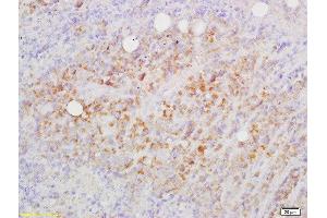 Formalin-fixed and paraffin embedded mouse lymphoma labeled with Rabbit Anti-CD82/KAI1 Polyclonal Antibody, Unconjugated  at 1:200 followed by conjugation to the secondary antibody and DAB staining