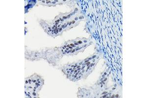 Immunohistochemistry of paraffin-embedded rat fallopian tube using Progesterone Receptor Rabbit pAb (ABIN6128570, ABIN6145518, ABIN6145519 and ABIN6213802) at dilution of 1:100 (40x lens).