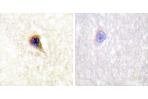 P-peptide - +Immunohistochemical analysis of paraffin-embedded human brain tissue using FAK (Phospho-Tyr576) Antibody (#A0426). (FAK antibody  (pTyr576))