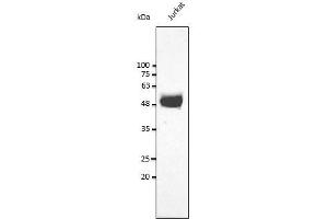 Anti-CD2 Ab at 1/2,500 dilution, Iysates at 50 ug per Iane, rabbit polyclonal to goat lgG (HRP) at 1/10,000 dilution, (CD2 antibody  (C-Term))