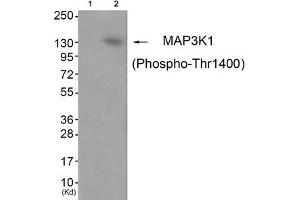 Western blot analysis of extracts from JK cells (Lane 2), using MAP3K1 (Phospho-Thr1400) Antibody. (MAP3K1 antibody  (pThr1402))