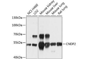 Western blot analysis of extracts of various cell lines, using CNDP2 antibody (ABIN6127642, ABIN6138771, ABIN6138772 and ABIN6214618) at 1:1000 dilution. (CNDP2 antibody  (AA 1-210))