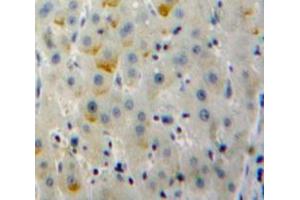 Immunohistochemistry (IHC) image for anti-CD79b Molecule, Immunoglobulin-Associated beta (CD79B) (AA 37-226) antibody (ABIN1859292)