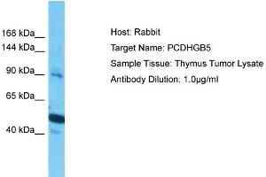 Host: Rabbit Target Name: PCDHGB5 Sample Type: Thymus Tumor lysates Antibody Dilution: 1. (PCDHGB5 antibody  (Middle Region))