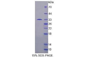 SDS-PAGE analysis of Human TCEA1 Protein. (TCEA1 Protein)
