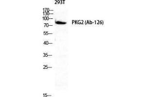 Western Blot (WB) analysis of 293T cells using cGKII Polyclonal Antibody.