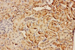 Anti-CISH antibody, IHC(P) IHC(P): Rat Kidney Tissue (CISH antibody  (C-Term))