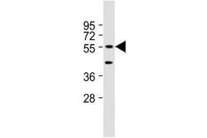 Western blot testing of mouse NIH3T3 cell lysate with DNAJC3 antibody at 1:2000. (DNAJC3 antibody  (AA 189-223))
