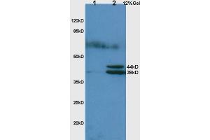L1 rat lung lysates L2 rat liver lysates probed with Anti Hpt/Haptoglobin Polyclonal Antibody, Unconjugated (ABIN734738) at 1:200 in 4 °C.