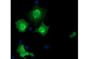 Anti-EPM2AIP1 mouse monoclonal antibody (ABIN2452993) immunofluorescent staining of COS7 cells transiently transfected by pCMV6-ENTRY EPM2AIP1 (RC209239). (EPM2AIP1 antibody)