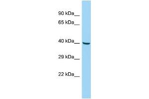 Host: Rabbit Target Name: SLC35G3 Sample Type: Fetal Liver lysates Antibody Dilution: 1. (SLC35G3 antibody  (N-Term))