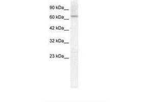 Image no. 1 for anti-Protein Inhibitor of Activated STAT, 2 (PIAS2) (C-Term) antibody (ABIN202826)