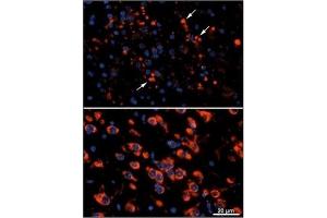 Immunofluorescence (IF) image for anti-Microtubule-Associated Protein 1 Light Chain 3 alpha (MAP1LC3A) antibody (ABIN1449372) (MAP1LC3A antibody)