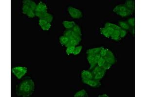 Immunofluorescent analysis of HepG2 cells using ABIN7169860 at dilution of 1:100 and Alexa Fluor 488-congugated AffiniPure Goat Anti-Rabbit IgG(H+L) (SMPX antibody  (AA 1-88))