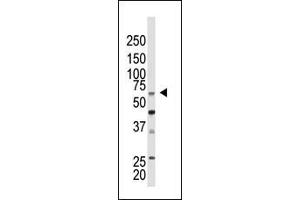 The anti-CBX4 N-term Pab (ABIN389086 and ABIN2839282) is used in Western blot to detect CBX4 in mouse kidney tissue lysate. (CBX4 antibody  (N-Term))