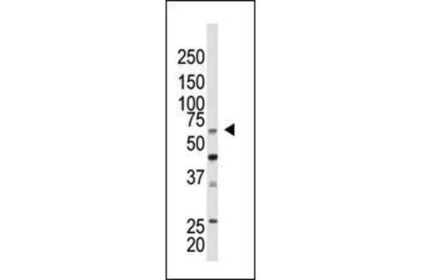 CBX4 antibody  (N-Term)