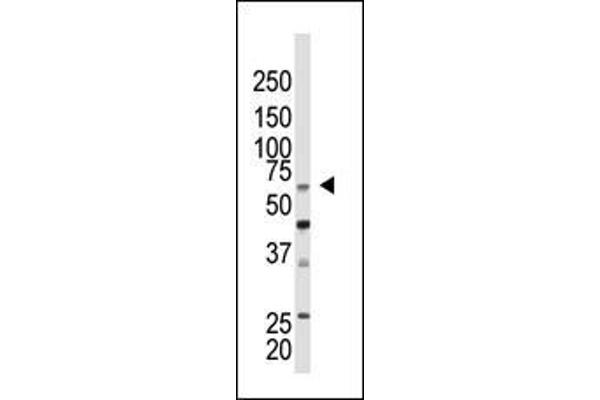 CBX4 antibody  (N-Term)