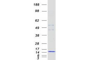 FCER1G Protein (Myc-DYKDDDDK Tag)
