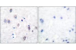 Immunohistochemistry analysis of paraffin-embedded human brain, using Amyloid beta A4 (Ab-743/668) Antibody. (APP antibody  (AA 711-760))