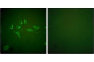 Immunofluorescence analysis of HepG2 cells, using iNOS Antibody. (NOS2 antibody  (AA 1101-1150))
