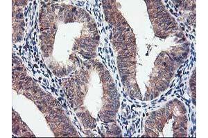 Image no. 2 for anti-Chromosome X Open Reading Frame 26 (CXorf26) antibody (ABIN1497690) (CXorf26 antibody)
