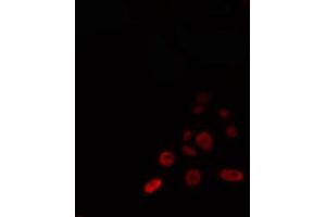 ABIN6274342 staining 293 cells by IF/ICC. (TOP3A antibody  (C-Term))