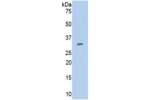 WB of Protein Standard: different control antibodies  against Highly purified E. (EGF ELISA Kit)