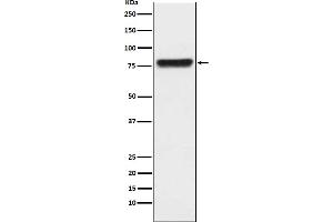 Western blot analysis of KLKB1 expression in human plasma lysate.