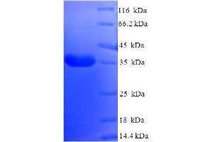 SDS-PAGE (SDS) image for DPY30 Domain Containing 2 (DYDC2) (AA 1-177), (full length) protein (His-SUMO Tag) (ABIN5711563)