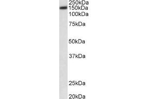 Western Blotting (WB) image for anti-ATPase, Ca++ Transporting, Plasma Membrane 1 (ATP2B1) (AA 312-327) antibody (ABIN5856985) (ATP2B1 antibody  (AA 312-327))