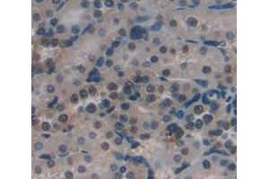 Figure. (Neurocan antibody  (AA 949-1214))