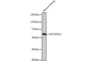 Western blot analysis of extracts of Mouse kidney, using K/K/Elp3 antibody (ABIN6130883, ABIN6140142, ABIN6140143 and ABIN6225217) at 1:1000 dilution. (ELP3/KAT9 antibody  (AA 358-547))