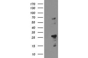 Image no. 1 for anti-Spastic Paraplegia 7 (SPG7) (AA 300-573) antibody (ABIN1491376) (SPG7 antibody  (AA 300-573))