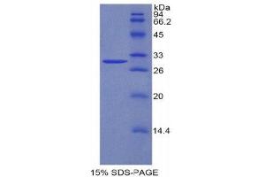 SDS-PAGE (SDS) image for Coagulation Factor V (F5) (AA 364-611) protein (His tag) (ABIN1878206) (Coagulation Factor V Protein (F5) (AA 364-611) (His tag))